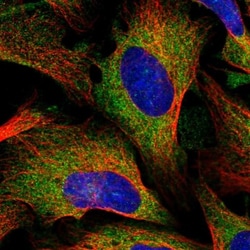 Lysyl tRNA synthetase Antibody, Novus Biologicals 0.1mL; Unlabeled:Antibodies,
